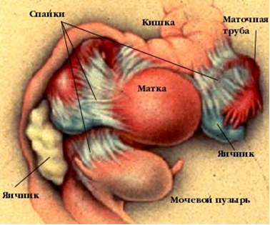 Где Находятся Маточные Трубы Фото